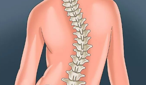 脊柱侧弯的四个自愈动作