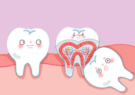 为什么不可以在姨妈期间拔智齿3
