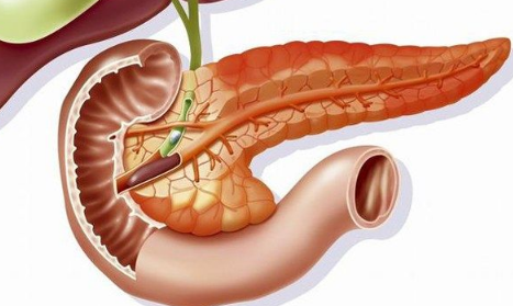 近期急性胰腺炎多发年轻人居多3