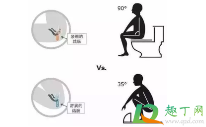 厕所堵了怎么通蹲便器4