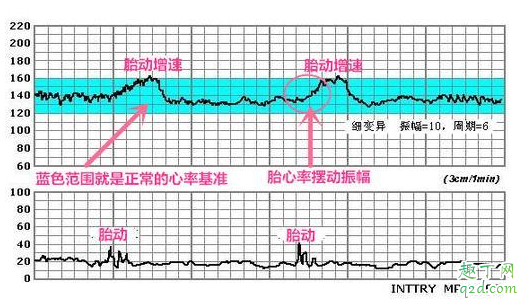 孕晚期每周都要做胎心监护吗 胎心监护很重要千万别怕麻烦3