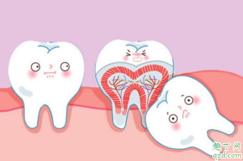 准备怀孕智齿一定要拔吗 准备怀孕有智齿但不痛需要拔吗2