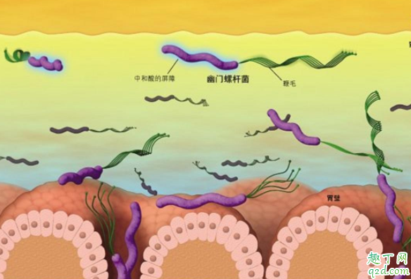 幽门螺杆菌抽血能查出来吗 查幽门螺杆菌怎么查3