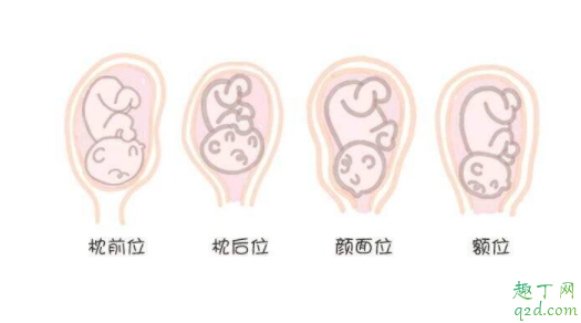 怀孕多久胎位就稳固了 正常的胎位是什么胎位2