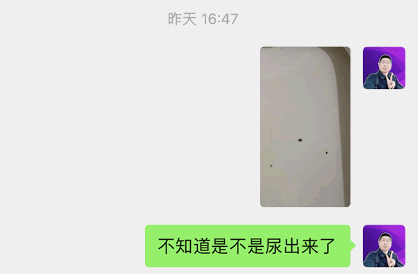 突然肾结石了：这时候我才意识到问题