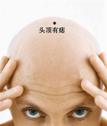 男人10处有痣是富贵痣,男人身体哪个部位长痣最好。