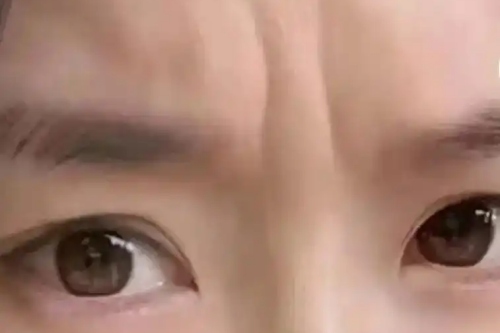 眉毛间两道竖纹代表什么