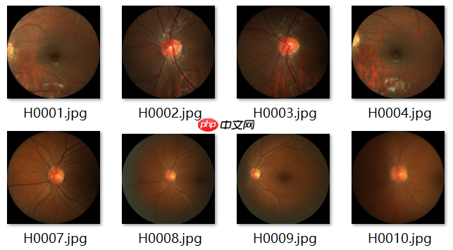 ResNet及BCD版本详解且在眼疾识别中应用实例 - 创想鸟