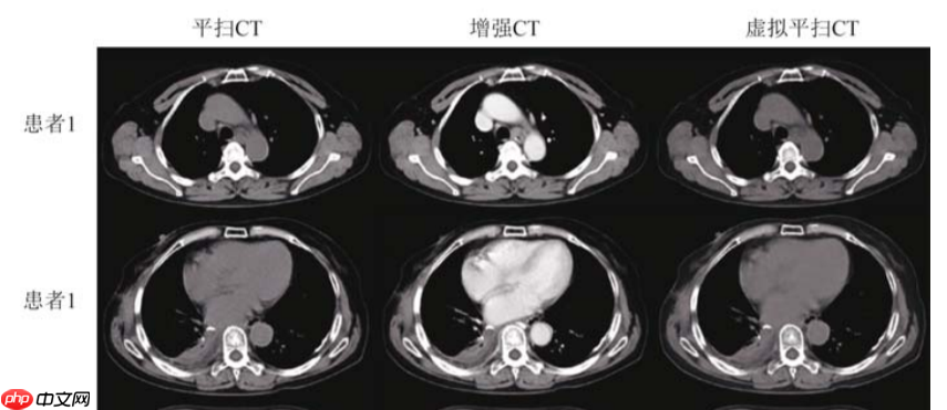 基于分割网络Unet生成虚拟图像 - 创想鸟