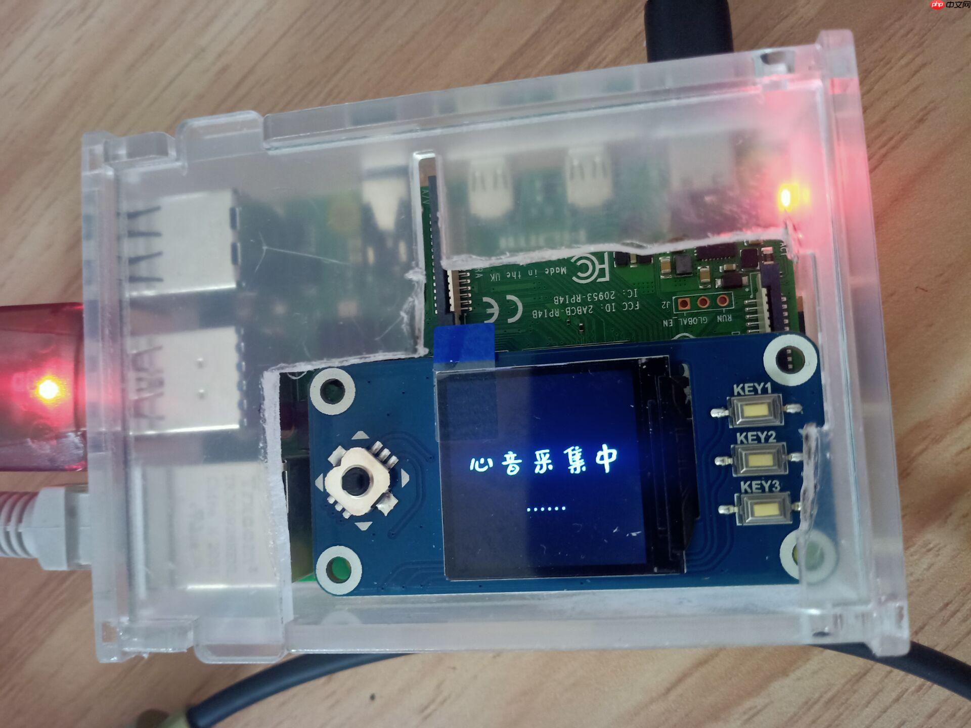 心音智能检测 - 创想鸟