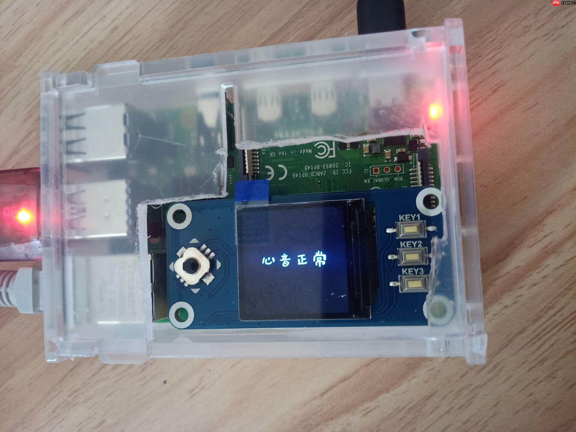 心音智能检测 - 创想鸟