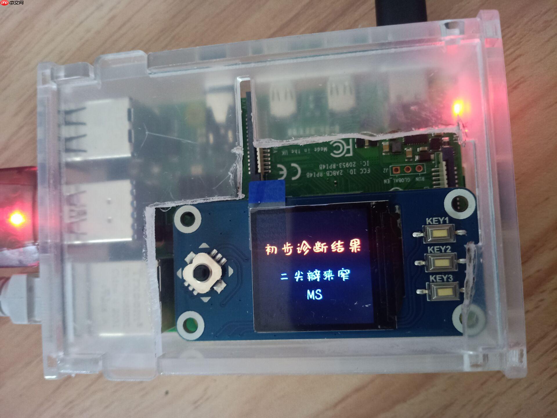 心音智能检测 - 创想鸟