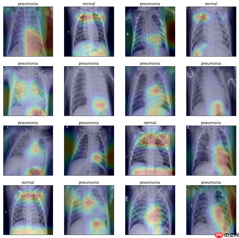 基于PaddlePaddle搭建儿童X光胸部肺炎分类项目 - 创想鸟