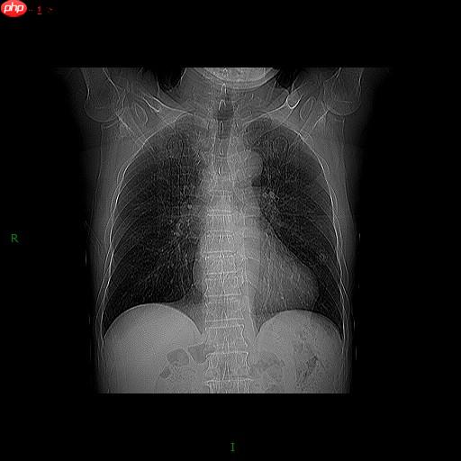图像分割预处理简单实用技巧 - 创想鸟