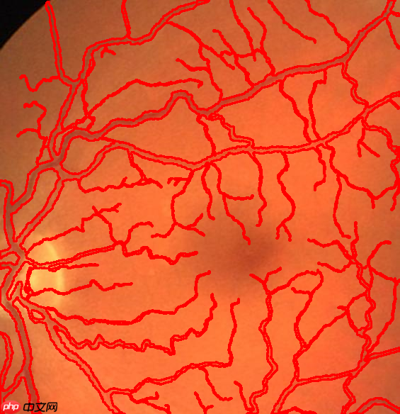 图像分割预处理简单实用技巧 - 创想鸟