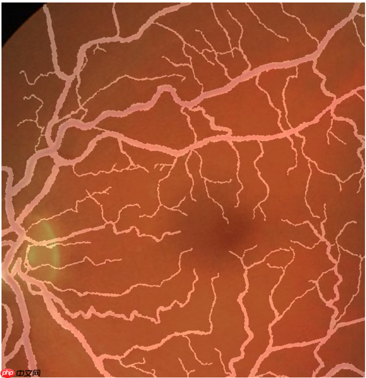 图像分割预处理简单实用技巧 - 创想鸟