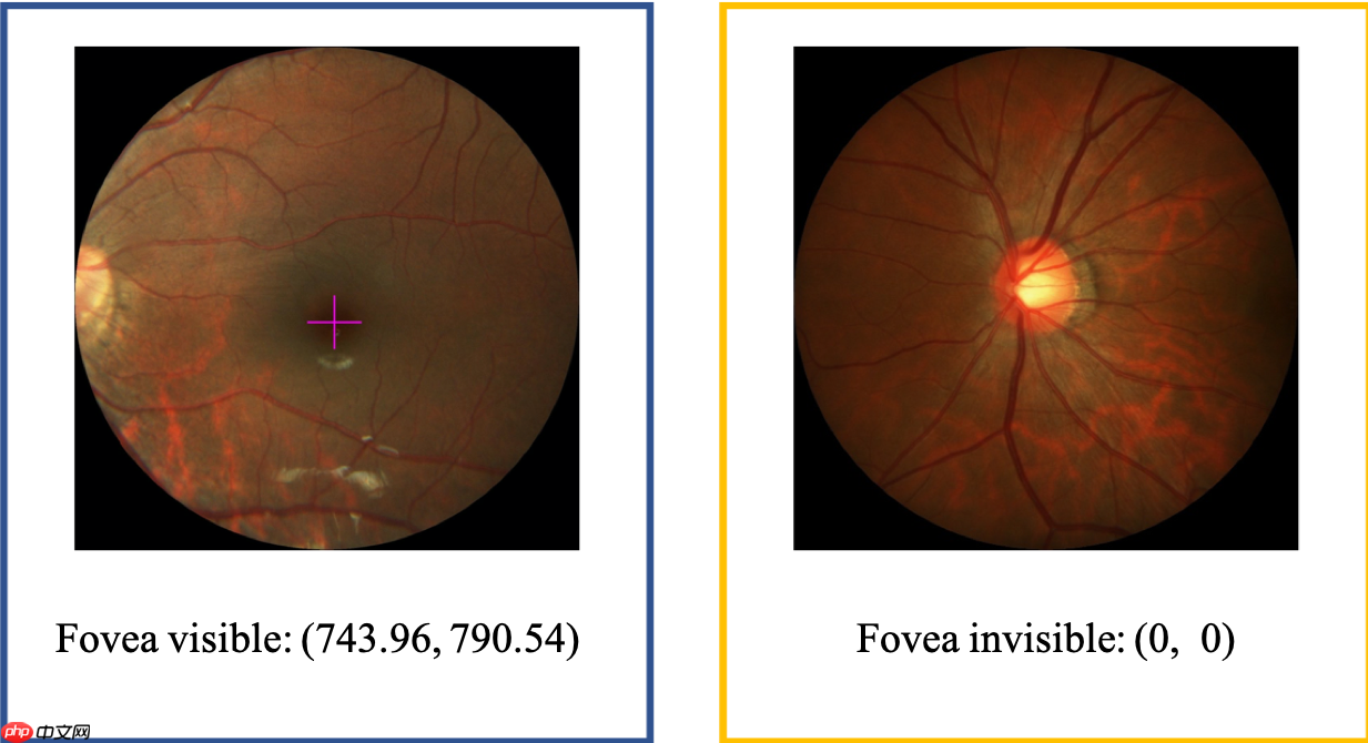 飞桨常规赛：黄斑中央凹定位（GAMMA挑战赛任务二） - 11月第3名方案 - 创想鸟