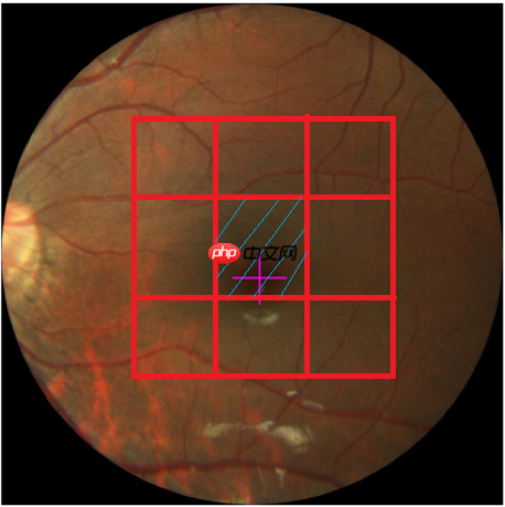 飞桨常规赛：黄斑中央凹定位（GAMMA挑战赛任务二） - 11月第3名方案 - 创想鸟