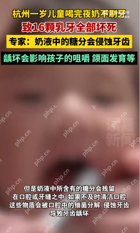 幼儿刚满一岁16颗乳牙全部坏死是怎么回事？详情介绍 - 创想鸟