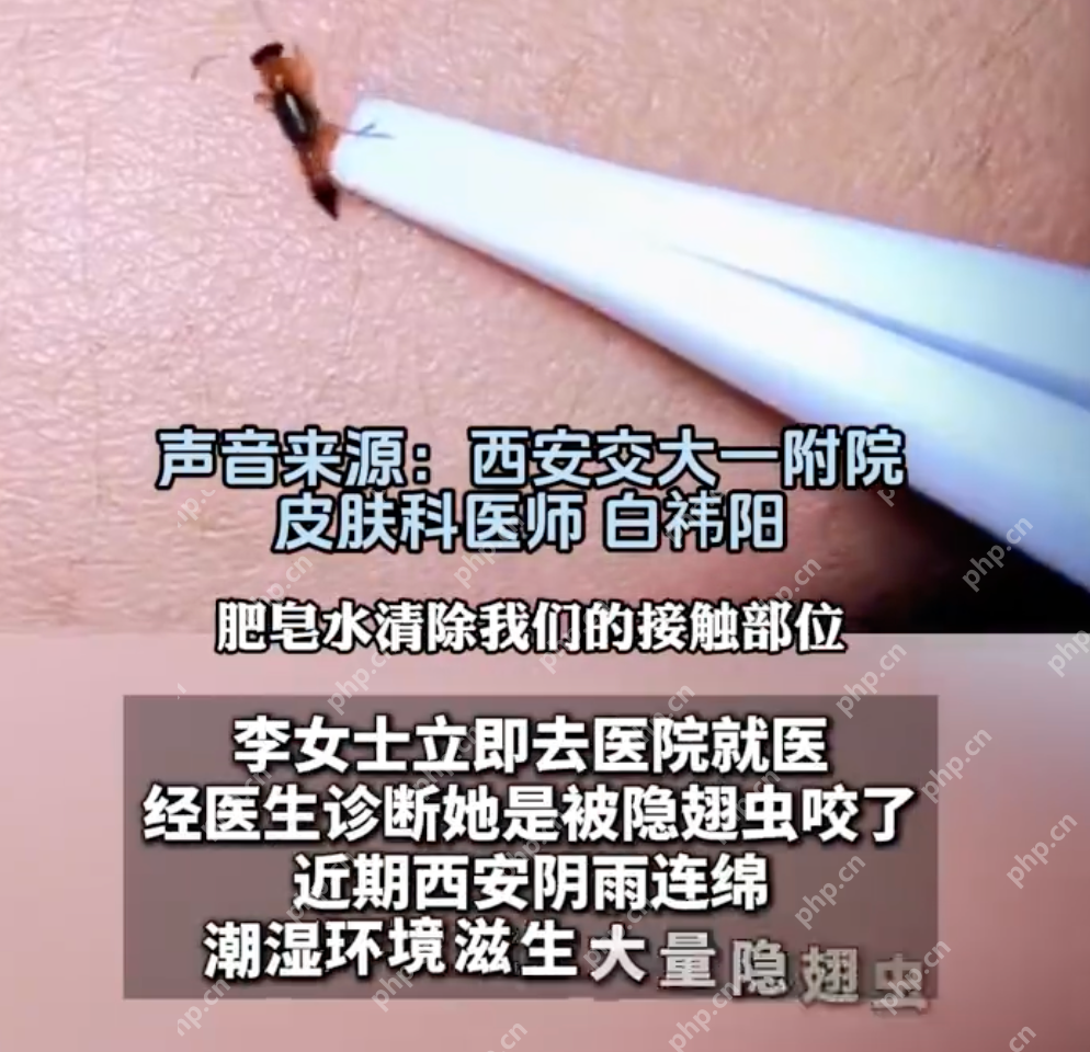 女子误认拉链划伤元凶竟是隐翅虫：伤害力堪比硫酸 - 创想鸟