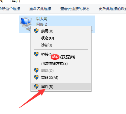 Win10系统以太网络电缆被拔出？