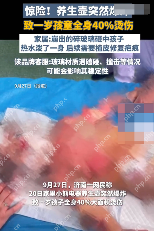 商家回应养生壶爆炸致1岁孩童烫伤：正在全力核查 - 创想鸟