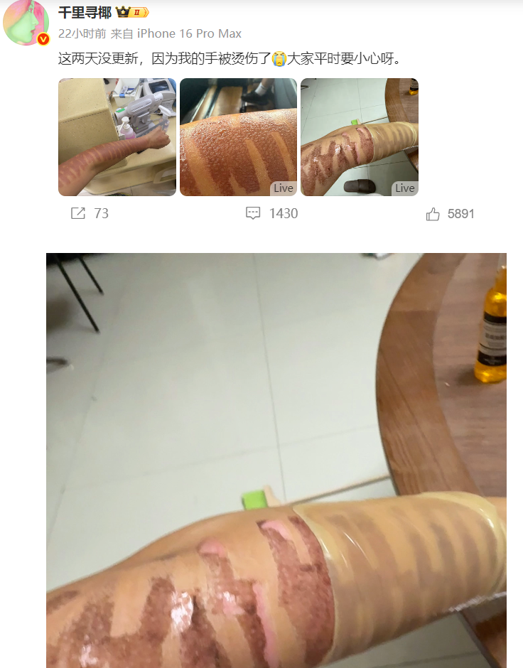网红做光子嫩肤竟遭深二度烧伤，涉事机构仅愿赔2万