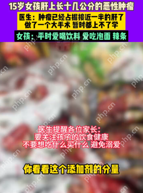 15岁女孩患癌肝被肿瘤占近半 女孩：平常爱喝饮料吃泡面辣条 - 创想鸟