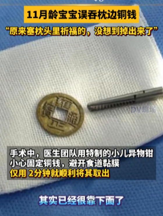 广州11月宝宝误吞枕边祈福币险窒息是怎么回事?详情介绍 - 创想鸟