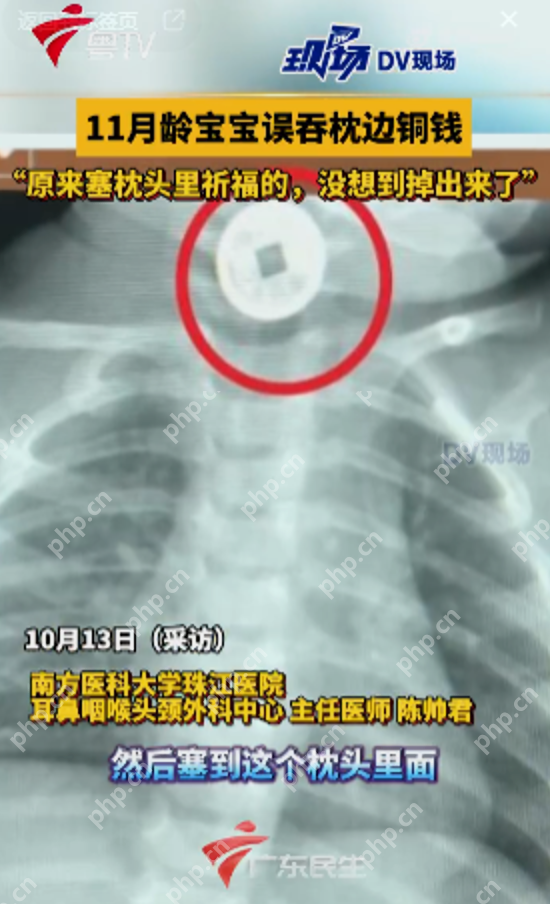 家长用铜钱当祈福币被宝宝误吞 医生提醒：“藏起危险”比任何祈福都更实际 - 创想鸟