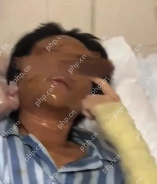 湖南一女主播遭伪装包裹炸伤，面部深二度烧伤。详情介绍 - 创想鸟