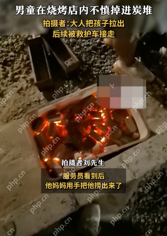 男童掉进烧烤店炭堆全身烧伤是怎么回事？详情介绍 - 创想鸟
