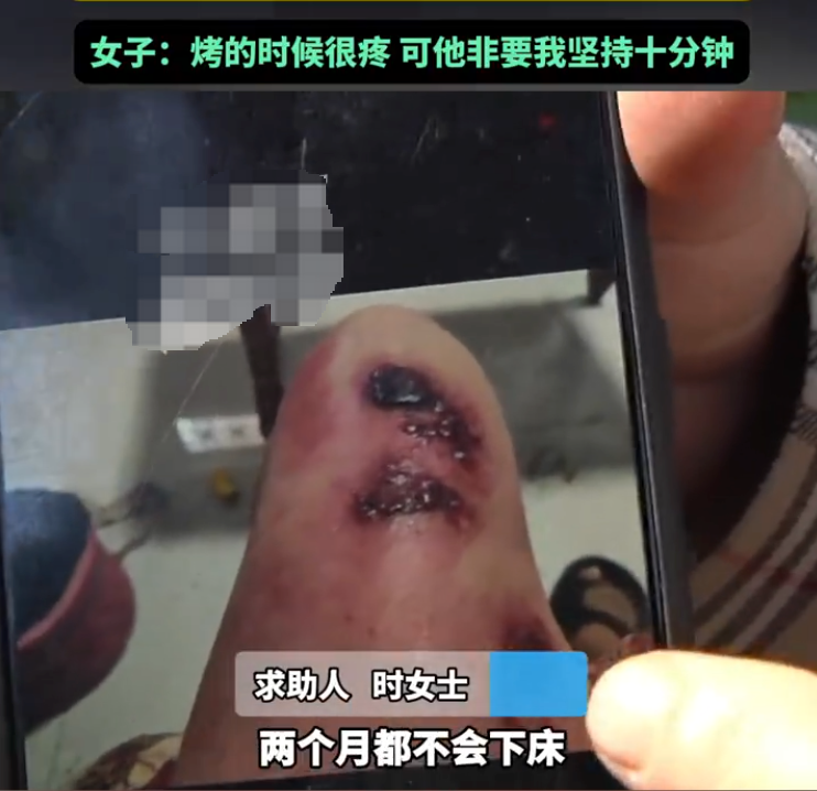 女子腿疼做理疗被烫伤无法下床 理疗馆反怼不知道躲 - 创想鸟