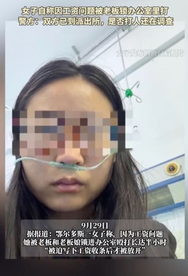 女子称因工资被老板殴打是怎么回事？详情介绍