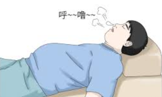 我国约1.7亿人患呼吸暂停综合征 睡眠呼吸暂停综合征有哪些