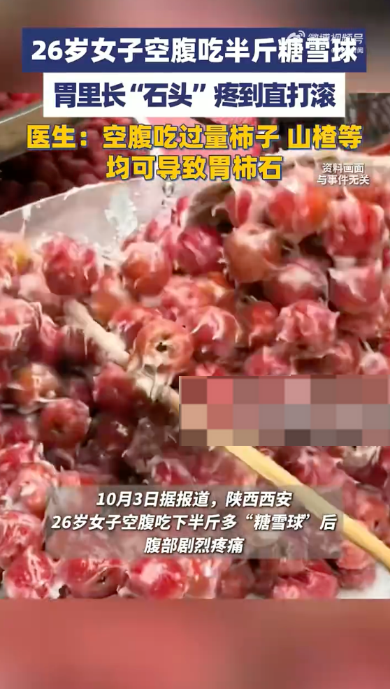 女子空腹吃半斤糖雪球腹中变成胃柿石是怎么回事？详情介绍