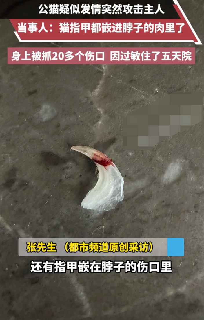 公猫疑似发情突然攻击主人 当事人：身上被抓20多个伤口