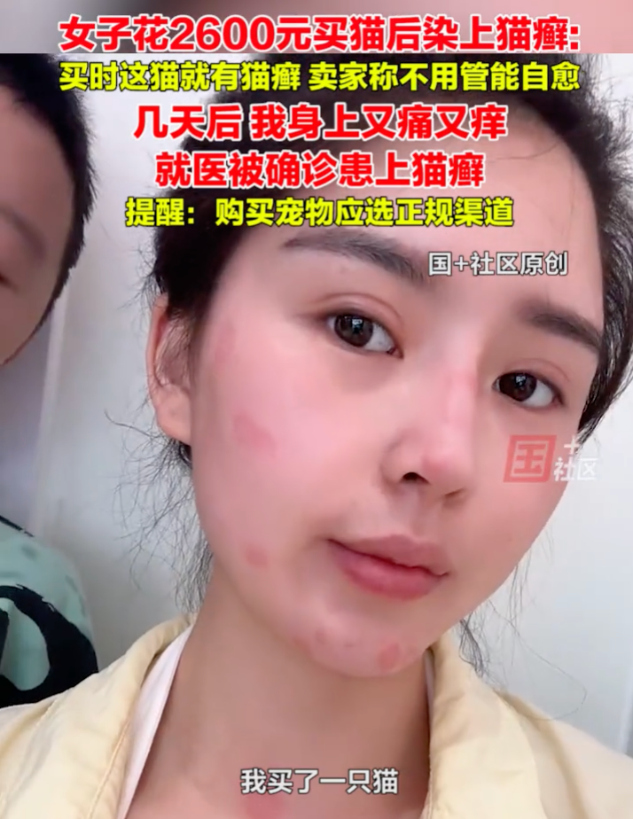 女子花2600元买猫后染上猫癣是怎么回事？详情介绍