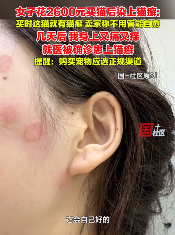女子花2600元买猫后染上猫癣：买时猫就有猫癣，卖家称不用管能自愈