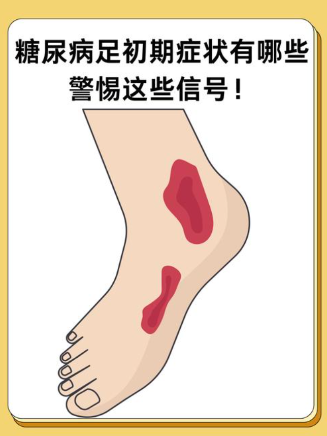 糖尿病男子管不住嘴10根脚趾被切除是怎么回事？详情介绍