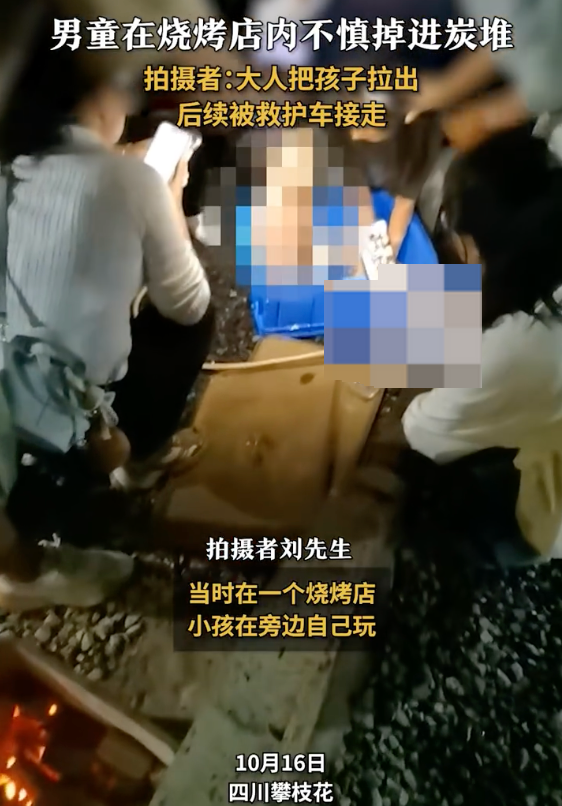 男童掉进烧烤店炭堆全身烧伤是怎么回事？详情介绍 - 创想鸟