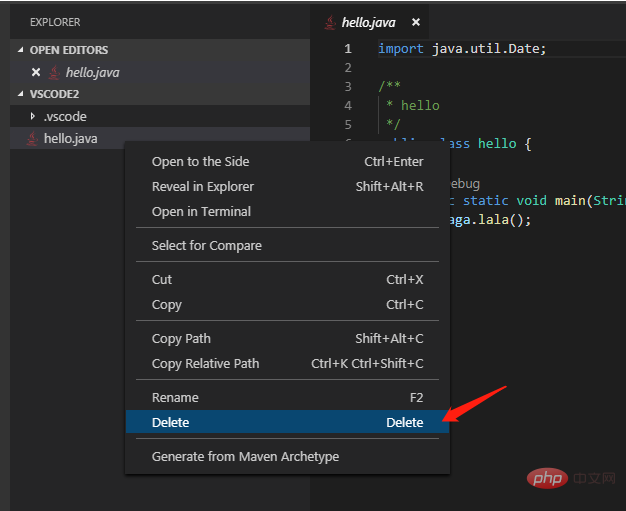 vscode删除的文件在哪里