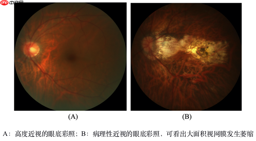 飞桨常规赛：PALM眼底彩照视盘探测与分割 – 8月第2名方案