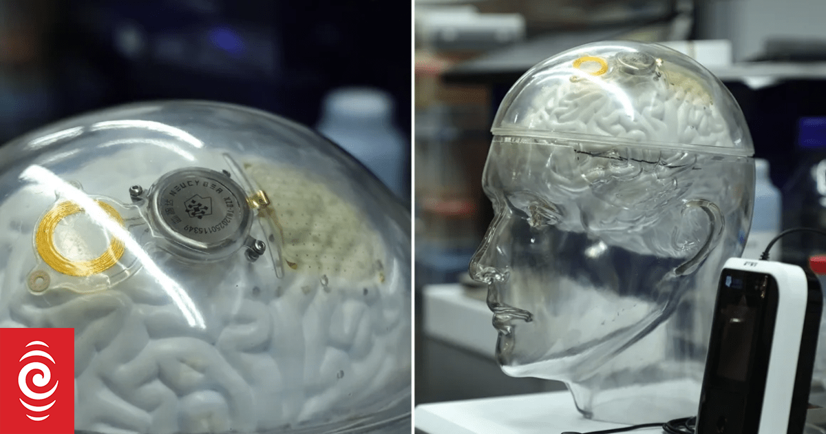 中国、脑机接口技术与Neuralink：一场通向未来的竞赛？