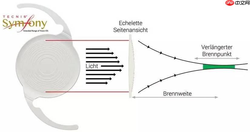 Symfony 如何将Cassandra行转为数组