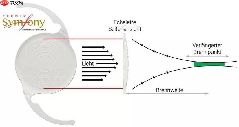 Symfony 怎样把插件配置转为数组
