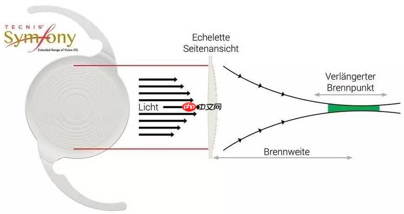 Symfony 怎么把请求参数转为对象